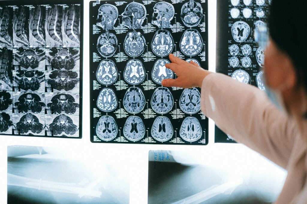 pexels-photo-4226264-4226264 Radiologist pointing at brain MRI scans showing detailed medical examination.